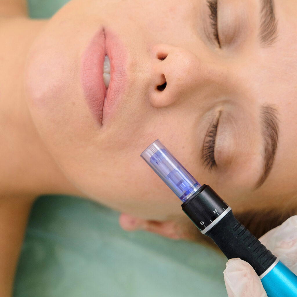 la medicina estética se vive como un cuidado integral del rostro, combinando precisión médica, tecnología avanzada y una experiencia sensorial que respeta la esencia de cada mujer.